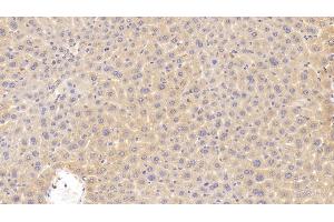 Detection of CDKN2B in Mouse Liver Tissue using Polyclonal Antibody to Cyclin Dependent Kinase Inhibitor 2B (CDKN2B) (CDKN2B antibody  (AA 1-130))