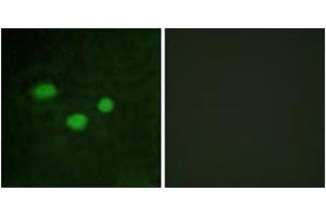 Immunofluorescence analysis of HeLa cells, using DNMT3B Antibody. (DNMT3B antibody  (AA 1-50))
