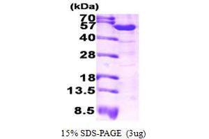 SDS-PAGE (SDS) image for Aldehyde Dehydrogenase 1 Family, Member A1 (ALDH1A1) (AA 1-501) protein (ABIN666900)