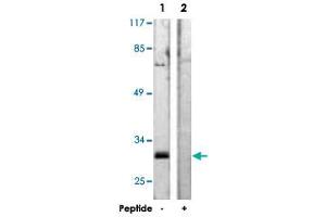 Western blot analysis of extracts from A-431 cells, using KCNIP3 polyclonal antibody .