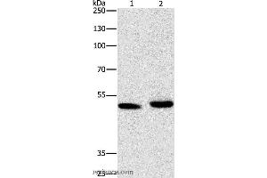Western blot analysis of 231 cell and human liver cancer tissue, using ATG4A Polyclonal Antibody at dilution of 1:300 (ATG4A antibody)