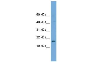 WB Suggested Anti-C14orf129 Antibody Titration: 0. (GSKIP antibody  (Middle Region))