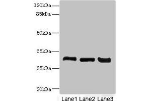 Western blot All lanes: KHKantibody at 3. (Ketohexokinase antibody  (AA 1-298))