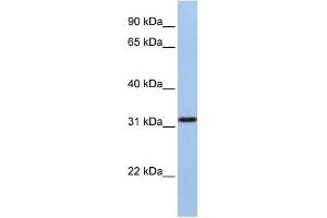 SLC25A28 antibody used at 1 ug/ml to detect target protein.