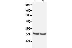 Anti-TIMP4 antibody, Western blotting All lanes: Anti TIMP4  at 0. (TIMP4 antibody  (C-Term))