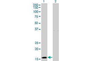 Western Blot analysis of IFNA2 expression in transfected 293T cell line by IFNA2 monoclonal antibody (M28), clone 1B4. (IFNA2 antibody  (AA 24-188))