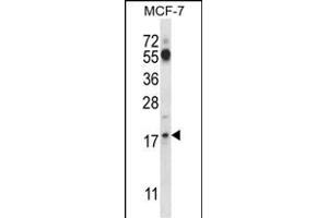 SSSCA1 Antibody (N-term ) (ABIN657577 and ABIN2846581) western blot analysis in MCF-7 cell line lysates (35 μg/lane). (SSSCA1 antibody  (N-Term))