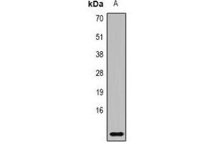 Western blot analysis of MRP8 expression in THP1 (A) whole cell lysates. (S100A8 antibody)
