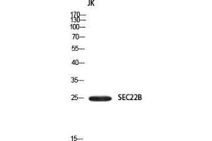 Western Blot (WB) analysis of JK using SEC22B antibody.