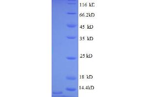Chemokine (C-X-C Motif) Ligand 3 (CXCL3) (AA 35-107), (full length) protein (His tag)
