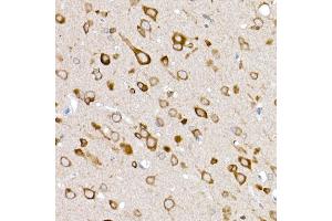 Immunohistochemistry of paraffin-embedded rat brain using GLUT3/SLC2 Rabbit pAb (ABIN6134111, ABIN6147961, ABIN6147962 and ABIN6224173) at dilution of 1:50 (40x lens). (SLC2A3 antibody  (AA 150-250))
