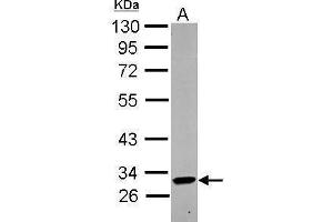 WB Image Sample (30 ug of whole cell lysate) A: THP-1 10% SDS PAGE antibody diluted at 1:1000 (KIR2DL4/CD158d antibody  (Center))