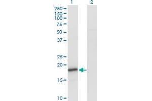 Western Blot analysis of SNCA expression in transfected 293T cell line by SNCA monoclonal antibody (M01), clone 2E4. (SNCA antibody  (AA 31-140))