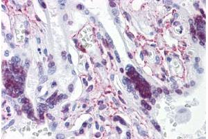 Human Placenta: Formalin-Fixed, Paraffin-Embedded (FFPE) (ATR antibody  (AA 2545-2645))