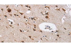 Immunohistochemistry of paraffin-embedded Human brain using Cathepsin L Polyclonal Antibody at dilution of 1:40 (Cathepsin L antibody)