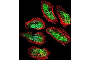 Fluorescent confocal image of Hela cell stained with TSN Antibody (Center) (ABIN656310 and ABIN2845612). (Translin antibody  (AA 109-138))