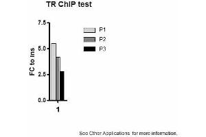 Image no. 1 for anti-Thyroid Hormone Receptor, beta (THRB) (N-Term) antibody (ABIN2779905) (THRB antibody  (N-Term))