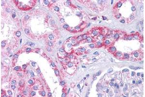 Human Kidney: Formalin-Fixed, Paraffin-Embedded (FFPE) (SIPA1L1 antibody  (N-Term))