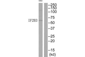 Western Blotting (WB) image for anti-Insulin-Like Growth Factor 2 mRNA Binding Protein 3 (IGF2BP3) (N-Term) antibody (ABIN1848922) (IGF2BP3 antibody  (N-Term))