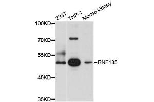 Western blot analysis of extracts of various cell lines, using RNF135 antibody (ABIN5996007) at 1/1000 dilution. (RNF135 antibody)
