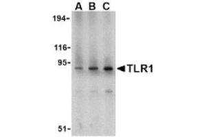 Image no. 1 for anti-Toll-Like Receptor 1 (TLR1) (N-Term) antibody (ABIN951276) (TLR1 antibody  (N-Term))