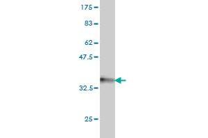 Western Blot detection against Immunogen (31. (HOXA7 antibody  (AA 58-112))