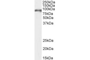 Western Blot using anti-CD155 antibody 3F1. (Recombinant Poliovirus Receptor antibody)