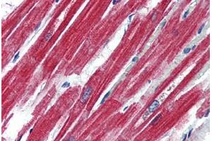 Human Heart (formalin-fixed, paraffin-embedded) stained with LEPR antibody ABIN364407 at 4 ug/ml followed by biotinylated anti-goat IgG secondary antibody ABIN481715, alkaline phosphatase-streptavidin and chromogen. (Leptin Receptor antibody  (AA 829-841))