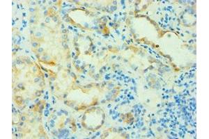 Immunohistochemistry of paraffin-embedded human kidney tissue using ABIN7144142 at dilution of 1:100 (SLC4A2 antibody  (AA 95-245))