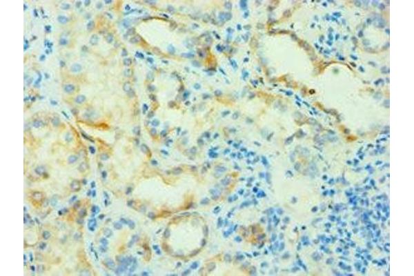 SLC4A2 antibody  (AA 95-245)