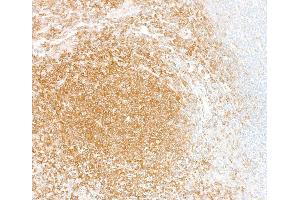 Immunohistochemistry (IHC) image for anti-Nuclear Factor-kB p65 (NFkBP65) (C-Term) antibody (ABIN7795799) (Recombinant NF-kB p65 antibody  (C-Term))