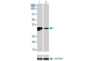 Western blot analysis of DLX3 over-expressed 293 cell line, cotransfected with DLX3 Validated Chimera RNAi (Lane 2) or non-transfected control (Lane 1). (DLX3 antibody  (AA 1-287))