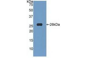 Detection of Recombinant TNFSF14, Human using Polyclonal Antibody to Tumor Necrosis Factor Ligand Superfamily, Member 14 (TNFSF14) (TNFSF14 antibody  (AA 62-240))