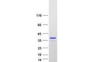 Validation with Western Blot (ALKBH2 Protein (Transcript Variant 1) (Myc-DYKDDDDK Tag))