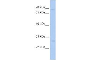 WB Suggested Anti-TLE4 Antibody Titration:  0. (TLE4 antibody  (N-Term))
