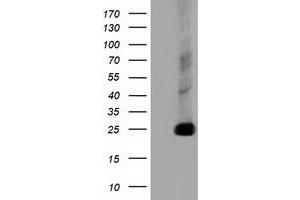 HEK293T cells were transfected with the pCMV6-ENTRY control (Left lane) or pCMV6-ENTRY CLPP (Right lane) cDNA for 48 hrs and lysed. (CLPP antibody)
