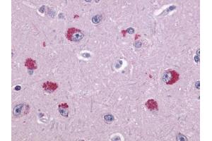 Anti-TAAR1 antibody IHC of human brain, neurons. (TAAR1 antibody  (Extracellular Domain))