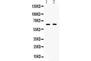 Western blot analysis of TUB 1 expression in COLO320 whole cell lysates ( Lane 1) and MCF-7 whole cell lysates ( Lane 2). (TUB antibody  (C-Term))
