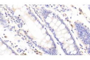 Detection of TJP2 in Human Colon Tissue using Polyclonal Antibody to Tight Junction Protein 2 (TJP2) (TJP2 antibody  (AA 307-669))