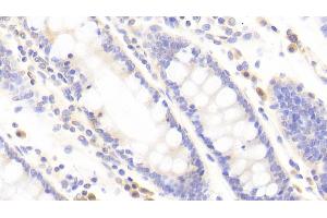 Detection of TJP2 in Human Colon Tissue using Polyclonal Antibody to Tight Junction Protein 2 (TJP2)