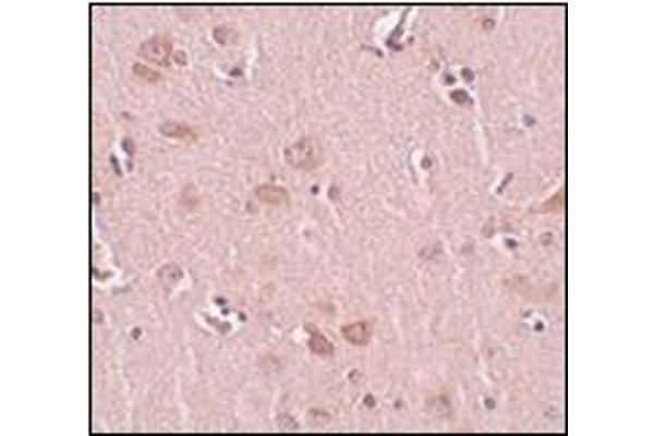 PLEKHM2 antibody  (C-Term)