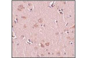 Immunohistochemistry of FAM59A in human liver tissue with this product at 5 μg/ml.