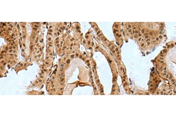 BCL7B antibody