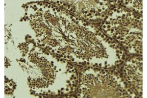 ABIN6273579 at 1/100 staining Mouse testis tissue by IHC-P. (ALKBH3 antibody  (Internal Region))