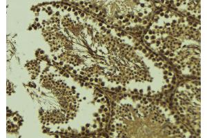 ABIN6273579 at 1/100 staining Mouse testis tissue by IHC-P. (ALKBH3 antibody  (Internal Region))