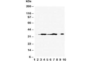 Western blot testing of Annexin V antibody and Lane 1:  rat brain;  2: rat skeletal muscle;  3: rat ovary;  4: rat lung;  5: MCF-7;  6: SMMC-7721;  7: A549;  8: Jurkat;  9: SGC;  10: HT1080;  Predicted molecular weight ~36 kDa.