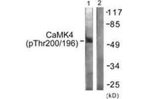 Western blot analysis of extracts from K562 cells treated with H2O2 100uM 30', using CaMK4 (Phospho-Thr196/200) Antibody. (CAMK4 antibody  (pThr200))