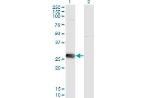 Western Blot analysis of SIRT3 expression in transfected 293T cell line by SIRT3 monoclonal antibody (M09), clone 1A4. (SIRT3 antibody  (AA 297-399))