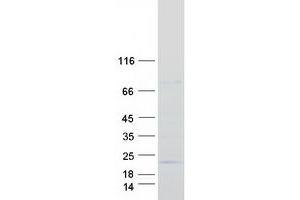 Validation with Western Blot (Proline Rich 13 Protein (PRR13) (Transcript Variant 2) (Myc-DYKDDDDK Tag))