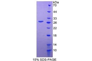 SDS-PAGE (SDS) image for Glutamate Dehydrogenase 1 (GLUD1) (AA 65-273) protein (His tag) (ABIN2124984) (GLUD1 Protein (AA 65-273) (His tag))